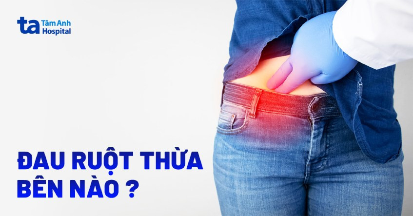 Vị trí đau ruột thừa thường gặp ở vùng bụng dưới bên phải