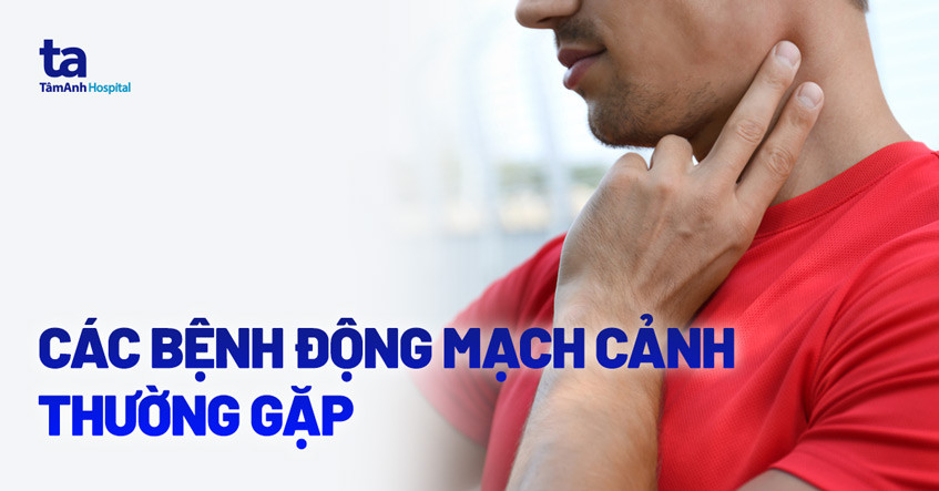 Vị trí động mạch cảnh trên cơ thể người, giúp nhận biết động mạch cảnh nằm ở đâu
