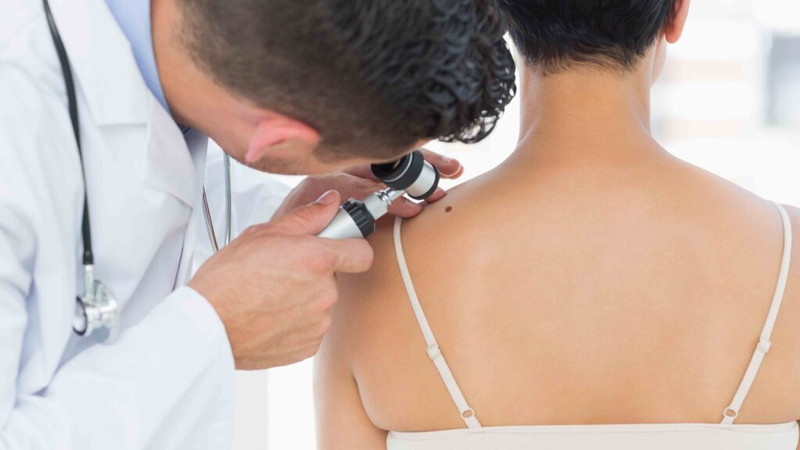 Dấu hiệu bất thường trên da cảnh báo cần đi khám da liễu sớm