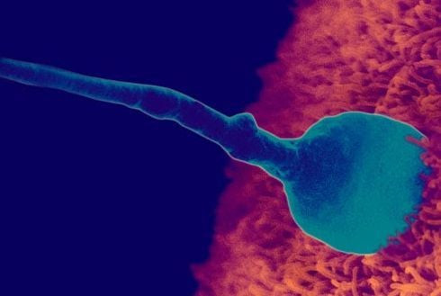 Hành trình gặp gỡ của tinh trùng và tế bào trứng, khởi đầu quá trình thụ tinh