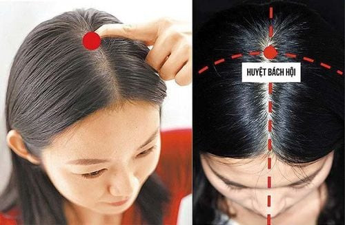 Hình ảnh minh họa vị trí chính xác của huyệt Bách Hội trên đỉnh đầu con người