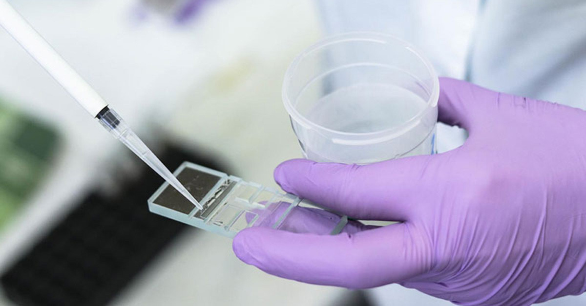 Hình ảnh mô tả các lợi ích của xét nghiệm tinh dịch đồ giúp đánh giá sức khỏe sinh sản nam giới