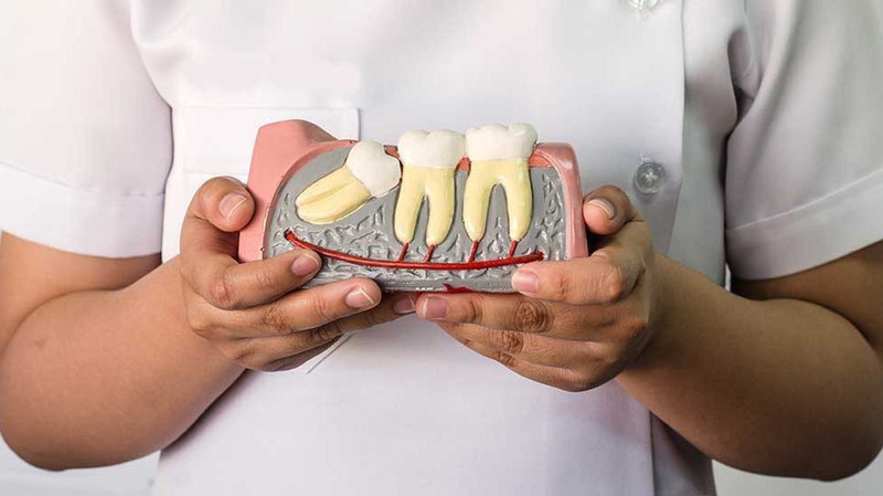 Nên nhổ răng khôn ở đâu khi bị đau