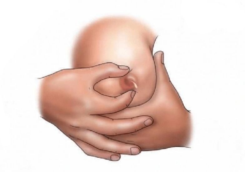 Người mẹ đang cho con bú và có thể gặp tình trạng nứt cổ gà ở đầu ti