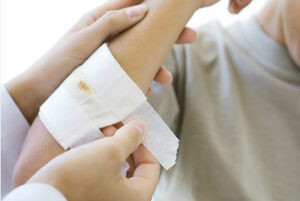 Sơ cứu vết thương té xe