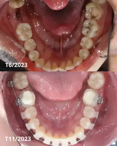 Keo Là Ai? Giải Mã Hiện Tượng Mạng Đang Thu Hút Sự Chú Ý Keo Là Ai? Giải Mã Hiện Tượng Mạng Đang Thu Hút Sự Chú Ý